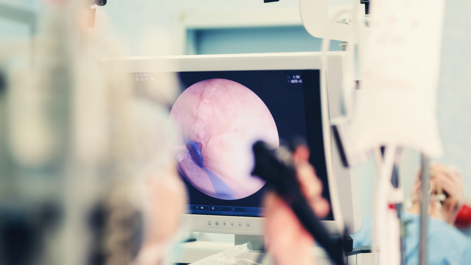 inteligencia artificial medicina